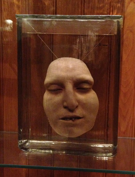 Mutter Museum photo
